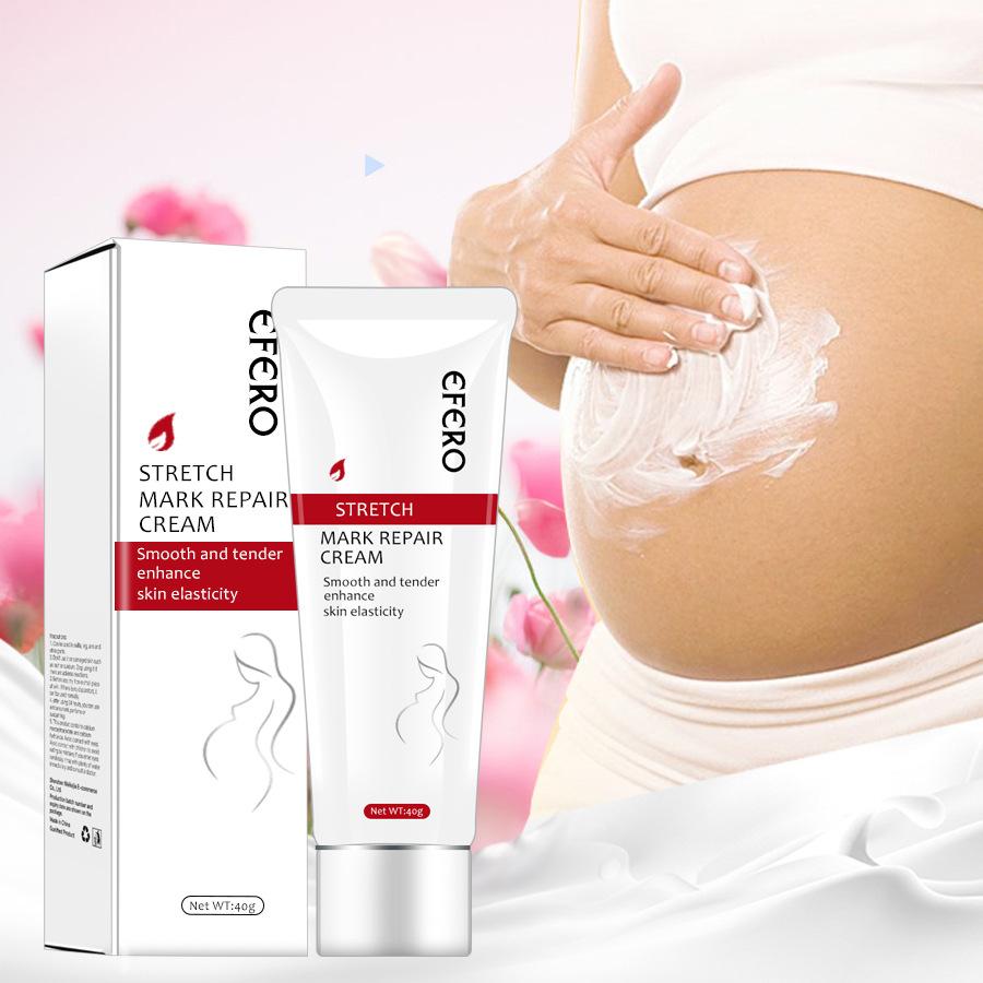 Postpartum Stretch Mark Removal Cream